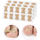Adesivo Corretor de Unhas Encravadas