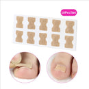 Adesivo Corretor de Unhas Encravadas